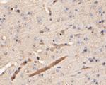 Cathepsin D Antibody in Immunohistochemistry (Paraffin) (IHC (P))