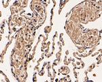 Cathepsin D Antibody in Immunohistochemistry (Paraffin) (IHC (P))