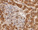 Cathepsin D Antibody in Immunohistochemistry (Paraffin) (IHC (P))