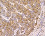 Cathepsin D Antibody in Immunohistochemistry (Paraffin) (IHC (P))