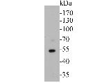 Thymidine Phosphorylase Antibody in Western Blot (WB)