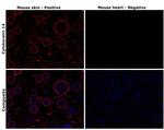 Cytokeratin 14 Antibody in Immunohistochemistry (Paraffin) (IHC (P))