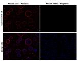 Cytokeratin 14 Antibody in Immunohistochemistry (Paraffin) (IHC (P))