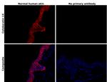 Cytokeratin 14 Antibody in Immunohistochemistry (Paraffin) (IHC (P))