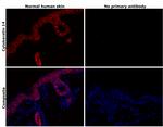 Cytokeratin 14 Antibody in Immunohistochemistry (Paraffin) (IHC (P))