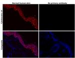 Cytokeratin 14 Antibody in Immunohistochemistry (Paraffin) (IHC (P))