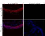 Cytokeratin 14 Antibody in Immunohistochemistry (Paraffin) (IHC (P))