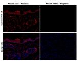 Cytokeratin 14 Antibody