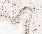 MTA2 Antibody in Immunohistochemistry (Paraffin) (IHC (P))