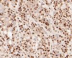 MTA2 Antibody in Immunohistochemistry (Paraffin) (IHC (P))