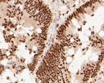 MTA2 Antibody in Immunohistochemistry (Paraffin) (IHC (P))