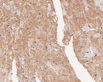 USP21 Antibody in Immunohistochemistry (Paraffin) (IHC (P))