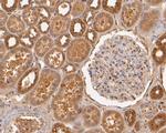 USP21 Antibody in Immunohistochemistry (Paraffin) (IHC (P))