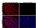 beta Catenin Antibody in Immunohistochemistry (Paraffin) (IHC (P))