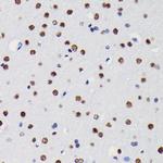 HDAC1 Antibody in Immunohistochemistry (Paraffin) (IHC (P))