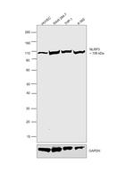 NLRP3 Antibody in Western Blot (WB)