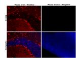 S100B Antibody in Immunohistochemistry (Paraffin) (IHC (P))