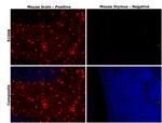 S100B Antibody in Immunohistochemistry (Paraffin) (IHC (P))