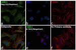 Laminin gamma-1 Antibody