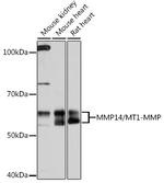 MMP14 Antibody in Western Blot (WB)