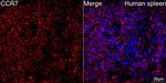 CCR7 Antibody in Immunohistochemistry (Paraffin) (IHC (P))