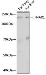 IFNAR1 Antibody in Western Blot (WB)