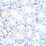 LAMP2 Antibody in Immunohistochemistry (Paraffin) (IHC (P))