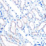 LAMP2 Antibody in Immunohistochemistry (Paraffin) (IHC (P))