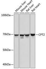 CPT2 Antibody in Western Blot (WB)