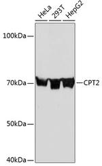 CPT2 Antibody in Western Blot (WB)