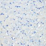 SR-BI Antibody in Immunohistochemistry (Paraffin) (IHC (P))