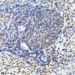 CDK4 Antibody in Immunohistochemistry (Paraffin) (IHC (P))