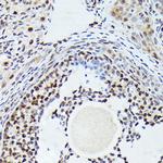 CDK4 Antibody in Immunohistochemistry (Paraffin) (IHC (P))