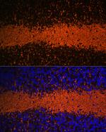 MBP Antibody in Immunohistochemistry (Paraffin) (IHC (P))