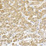 ATP Synthase beta Antibody in Immunohistochemistry (Paraffin) (IHC (P))