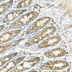 ATP Synthase beta Antibody in Immunohistochemistry (Paraffin) (IHC (P))