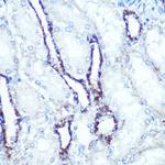 ATP5A1 Antibody in Immunohistochemistry (Paraffin) (IHC (P))