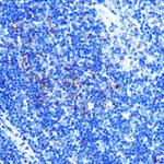 ATP5A1 Antibody in Immunohistochemistry (Paraffin) (IHC (P))