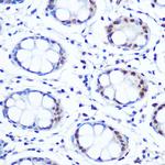 APE1 Antibody in Immunohistochemistry (Paraffin) (IHC (P))