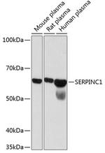 SERPINC1 Antibody in Western Blot (WB)