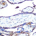 CD55 Antibody in Immunohistochemistry (Paraffin) (IHC (P))