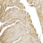 C1QBP Antibody in Immunohistochemistry (Paraffin) (IHC (P))