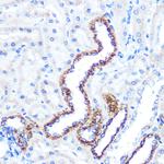 Angiopoietin 2 Antibody in Immunohistochemistry (Paraffin) (IHC (P))