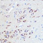 GluR2 Antibody in Immunohistochemistry (Paraffin) (IHC (P))