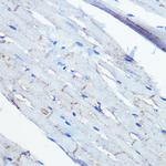 Ephrin B2 Antibody in Immunohistochemistry (Paraffin) (IHC (P))