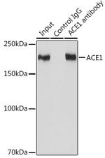 ACE Antibody in Immunoprecipitation (IP)