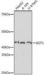 GOT1 Antibody in Western Blot (WB)