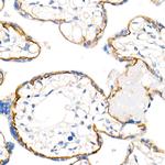 delta Catenin Antibody in Immunohistochemistry (Paraffin) (IHC (P))