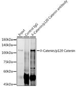 delta Catenin Antibody in Immunoprecipitation (IP)