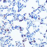 GM130 Antibody in Immunohistochemistry (Paraffin) (IHC (P))